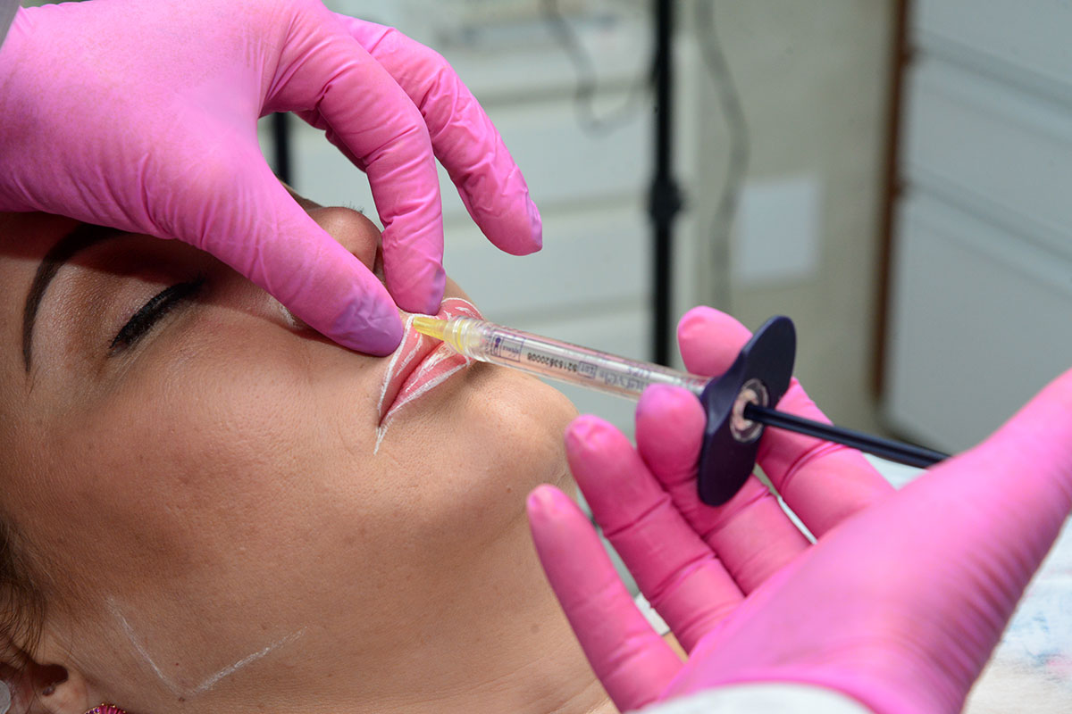 Preenchimento facial
